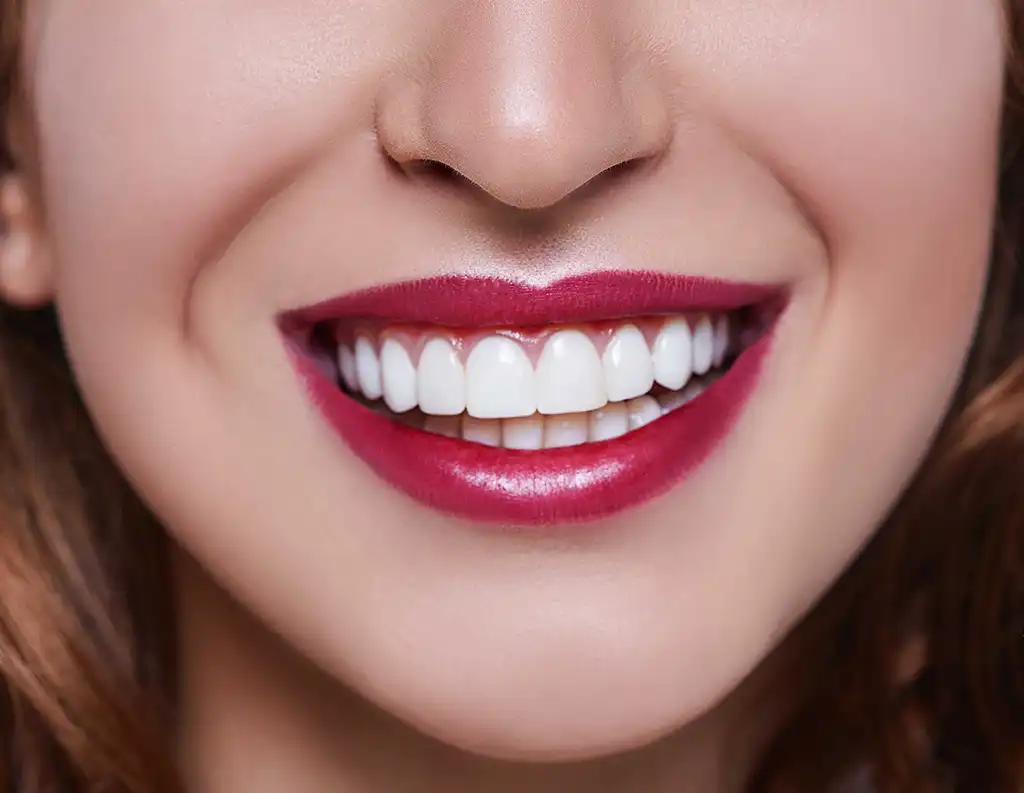 Emax Diş Kaplama Nedir? Kimler Tercih Etmeli? | Santral Klinik